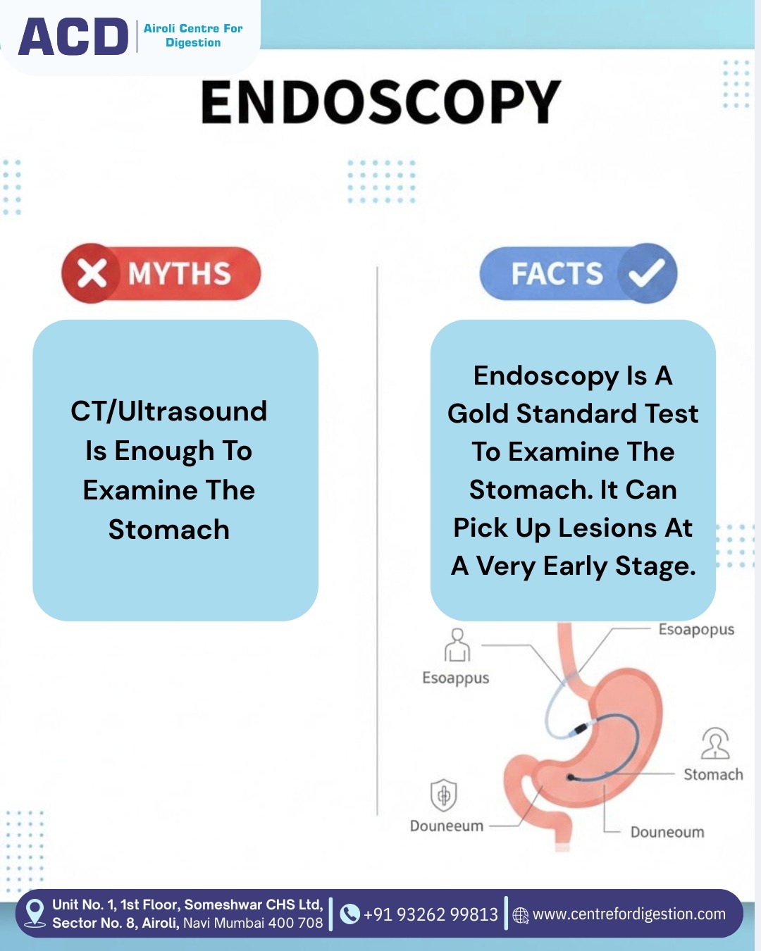 Endoscopy Mths & Facts
