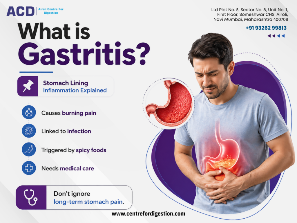 stomach pain with gastritis awareness and stomach inflammation illustration.