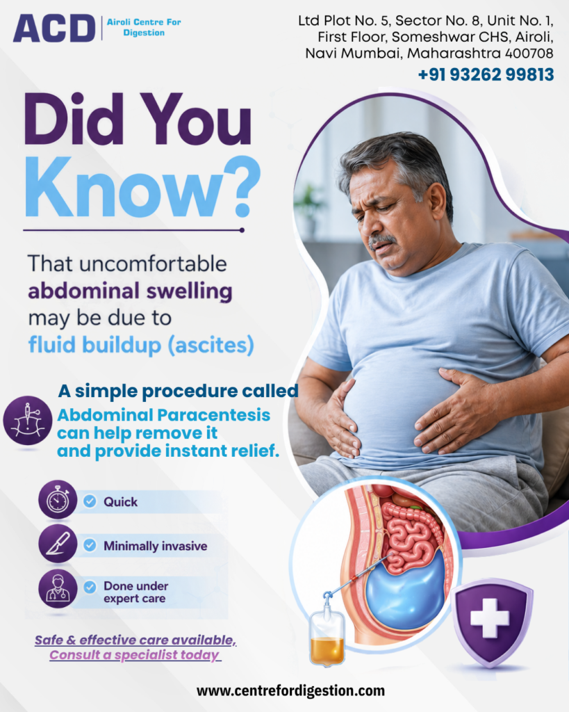 Ascites causing abdominal swelling