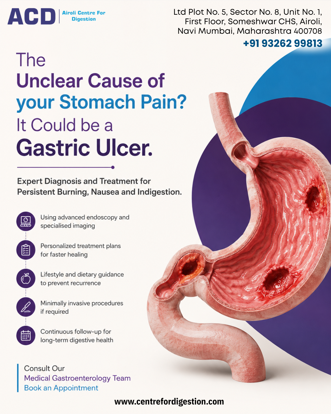 Gastric ulcer and stomach health awareness graphic.